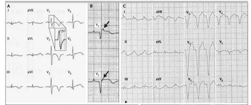吃瓜心电图视频,揭秘瓜界“心跳”的秘密